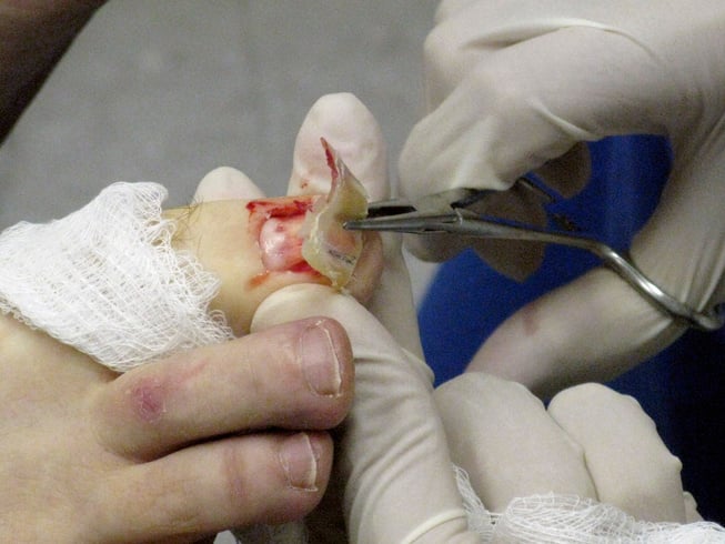 Podiatric surgery